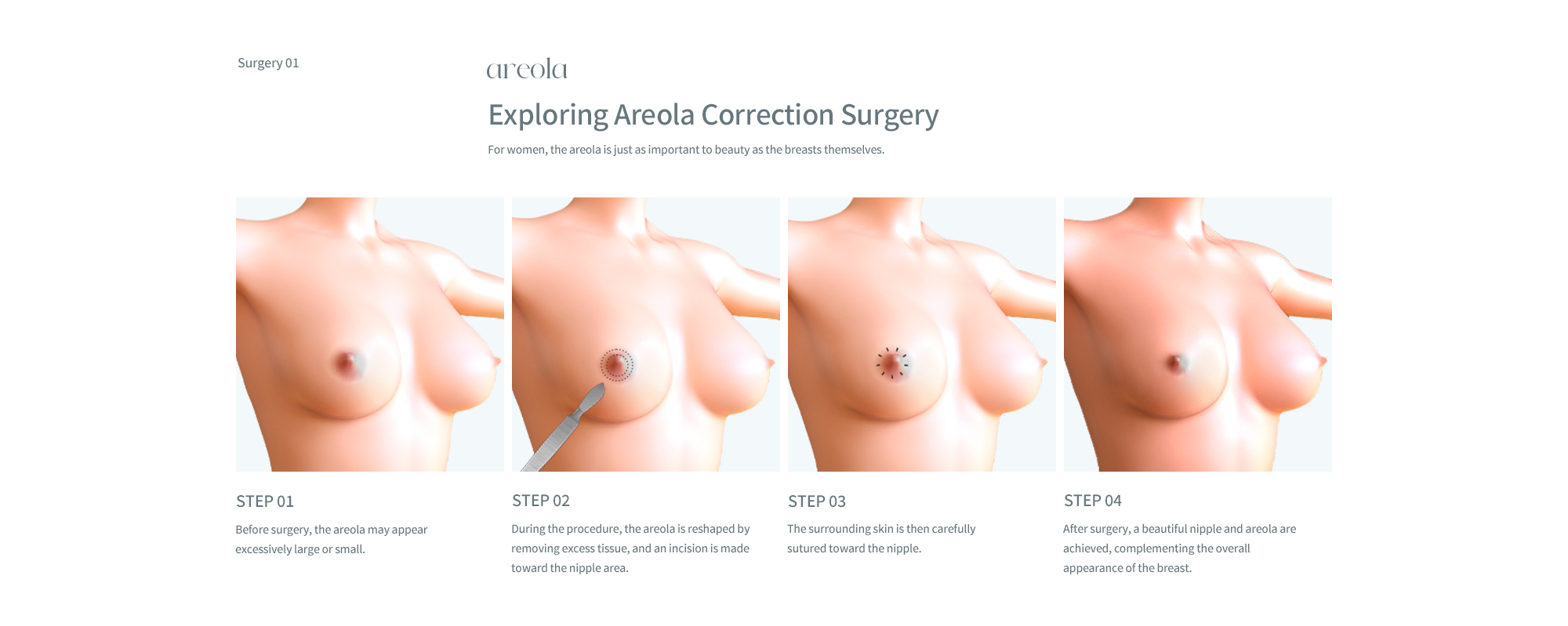 Areola/Nipple