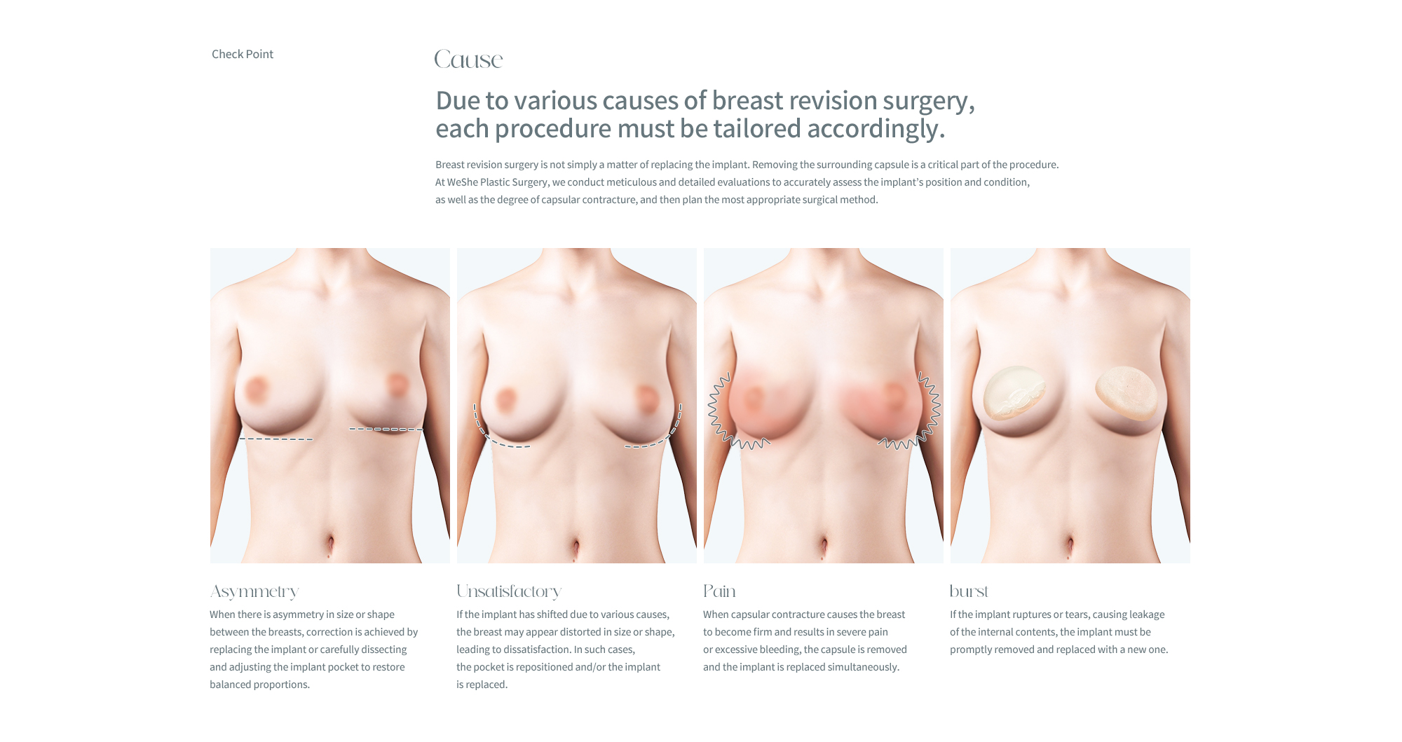 Revision Surgery